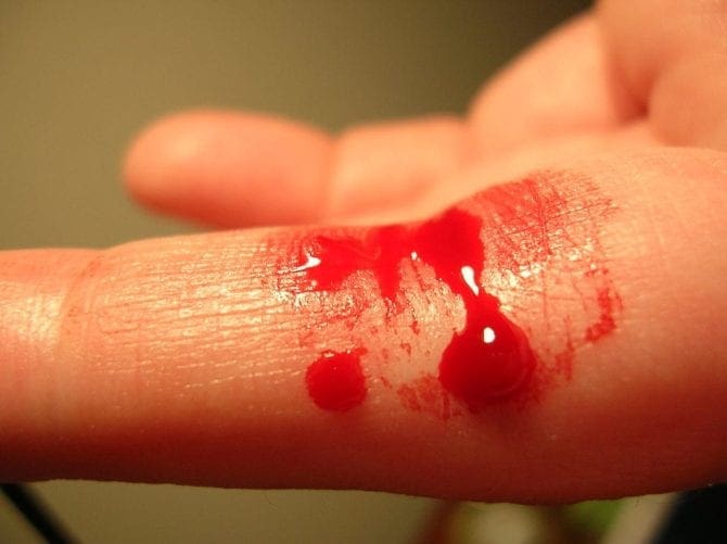 Finger