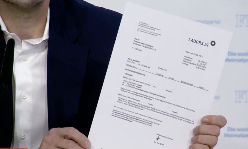 Labortest Kickl